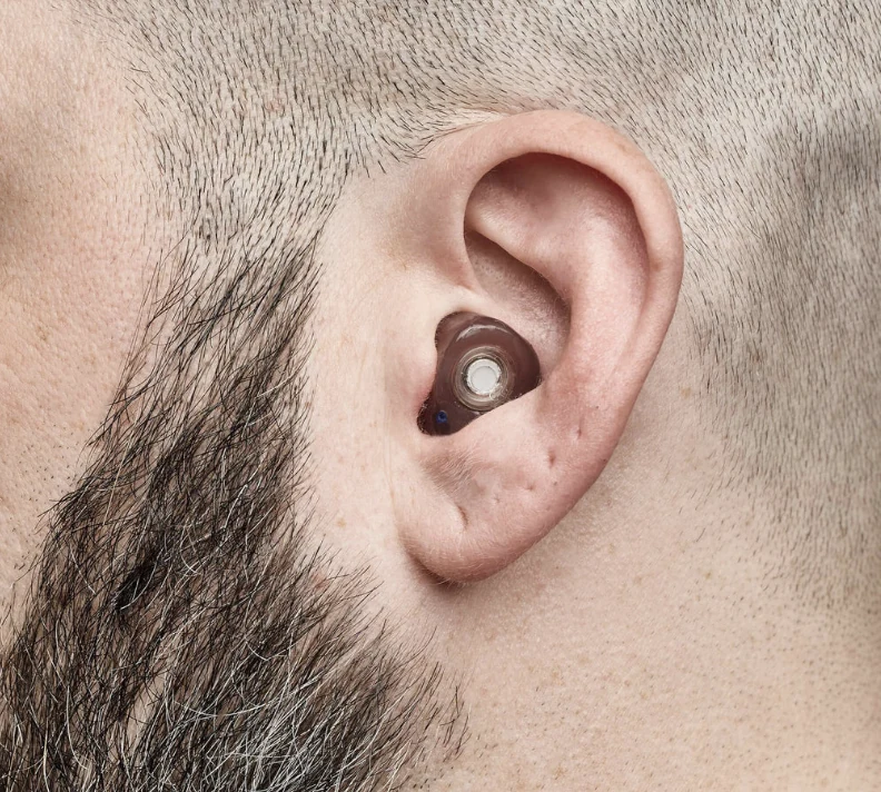 A custom filtered earplug fitted securely in an adult patient’s ear