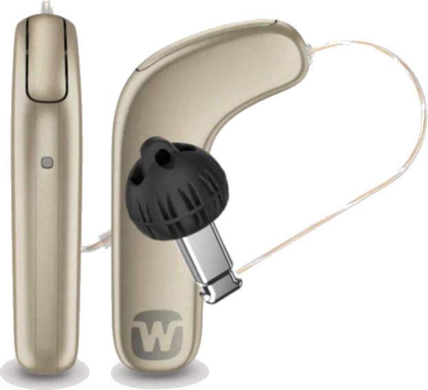 Widex SmartRIC hearing aid, Pinnacle Audiology NYC
