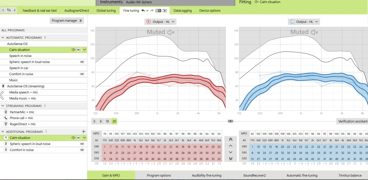 Hearing-aid fitting software displaying right and left prescription output curves